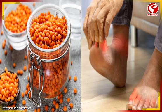 ইউরিক অ্যাসিডেও খেতে পারবেন মুসুর ডাল! কী বলছেন চিকিৎসকরা?