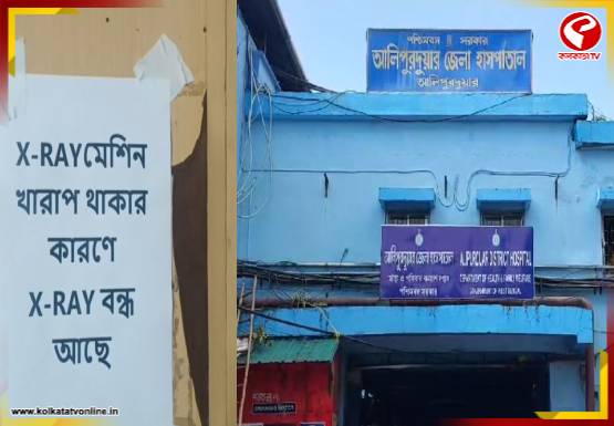 আলিপুরদুয়ার হাসপাতালে বন্ধ ডিজিটাল এক্স-রে পরিষেবা, ভোগান্তি