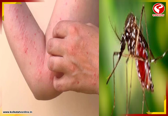 ফের চিকুনগুনিয়ার আতঙ্ক কেরলে! নির্দেশ অমান্য করলে ১০ হাজার টাকা জরিমানা