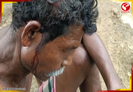 ভোটে রক্ত ঝরল পিংলা বিধানসভায়, অশান্তির ছবি সবংয়েও  